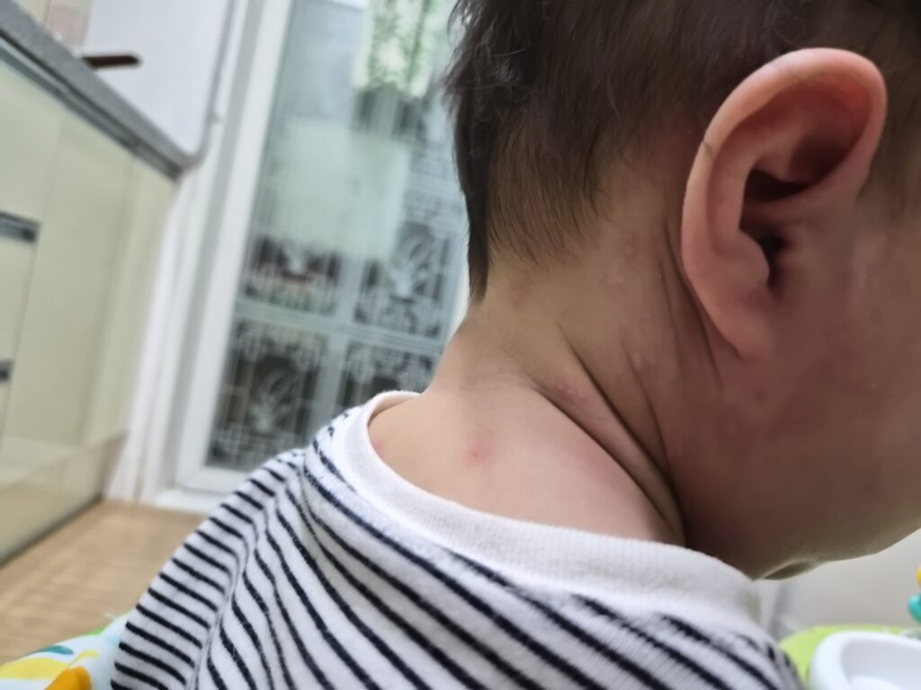 11month-baby-flour-Allergie